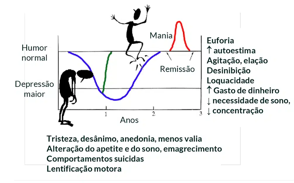 As mudanças na bipolaridade tipo 1 e tipo 2